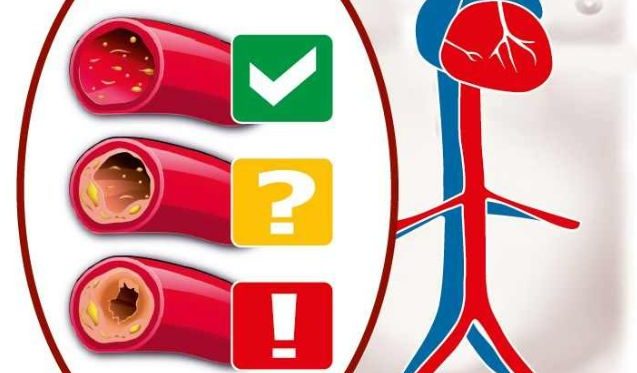 Érállapot, érszűkület, érrugalmasság mérés a munkahelyen